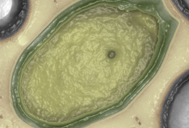  Вирус Пандора в оптическом микроскопе — обработанное изображение Фото: IGS CNRS-AMU