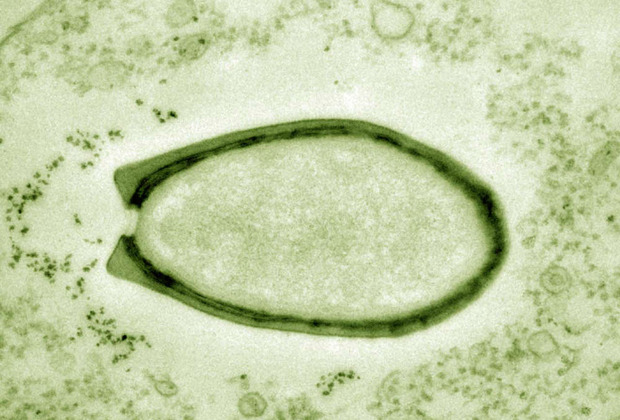  Вирус Пандора в оптическом микроскопе Фото: IGS CNRS-AMU